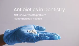 antibiotic tablets used in dental infection treatment.